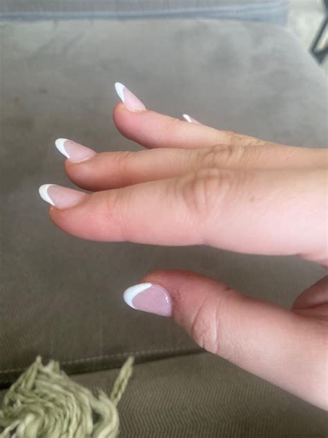 What To Do About Nails That Grow Upwards Rnails