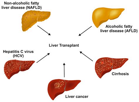 Cimb Free Full Text Recent Advances In Liver Tissue Engineering As An Alternative And