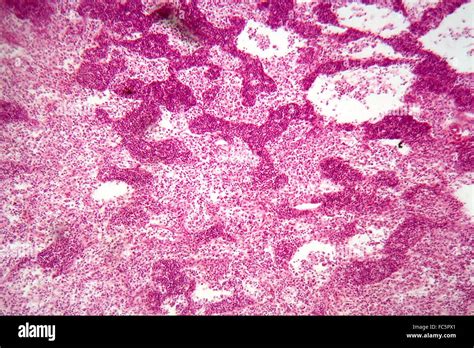 Lymph node under the microscope Stock Photo - Alamy