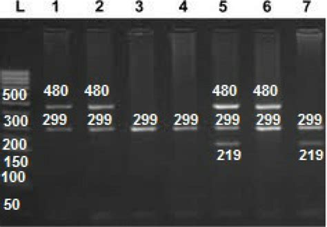 Electrophoretic Analysis For Gstm And Gstt Null Genotypes Multiplex