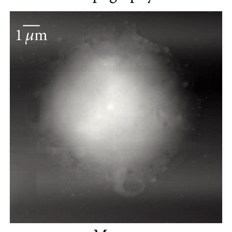 NSOM QD Based Dual Color Imaging Of CD3 And GM1 For Unstimulated