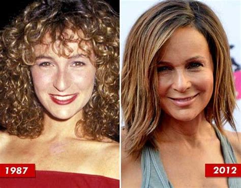 Jennifer Grey Before And After Nose Job Photos Plastic Surgery Magazine