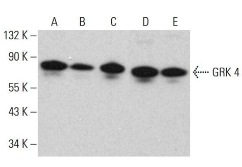 GRK 4抗体 D 11 SCBT Santa Cruz Biotechnology