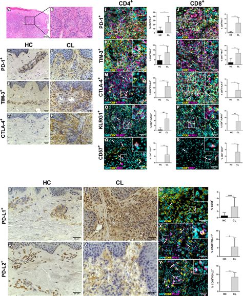 Frontiers Pd Blockade Modulates Functional Activities Of Exhausted