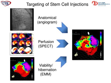 Effect Of Transendocardial Delivery Of Autologous Bone Marrow