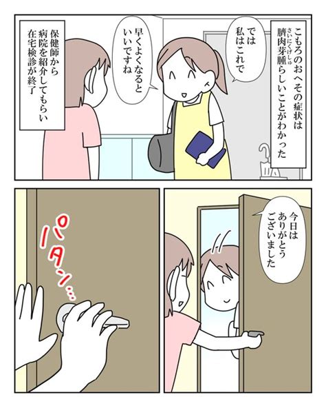 臍ヘルニアだと思ったら「臍肉芽腫」だった話 44 Moro＠単行本発売中 さんのマンガ ツイコミ仮