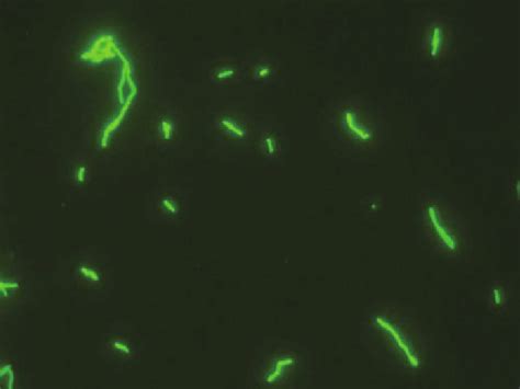 1 Epifluorescence Microscopy Photography Of Legionella Pneumophila Download Scientific Diagram