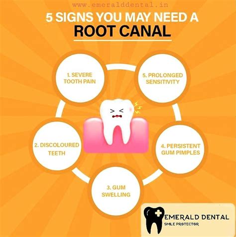 5 SIGNS YOU MAY NEED A ROOT CANAL EMERALD DENTAL