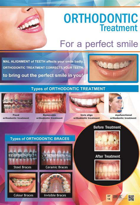 Types Of Orthodontic Treatment Different Types Of Braces Eng Dp 14