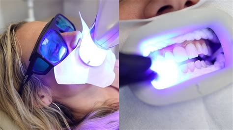 The 10 Ideal Teeth Lightening Strips Of 2024 Evaluated And Assessed