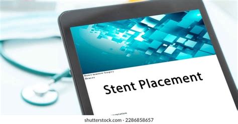 Stent Placement Royalty-Free Images, Stock Photos & Pictures | Shutterstock