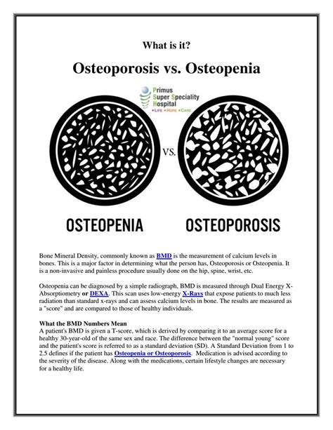 Osteoporosis vs osteopenia by Primus Super Speciality Hospital - Issuu