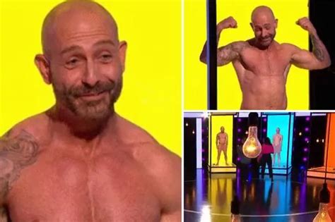 Naked Attraction Star Debuts Painful Op Results As Daddy Moniker Pushed Him To Surgery Daily