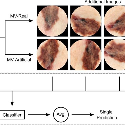 Illustration Of The Multiview Approach Top For Both The Mv Artificial