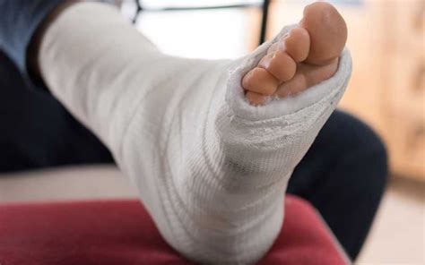 Leg, Knee & Ankle Fracture Compensation Claims | McCarthy + Co