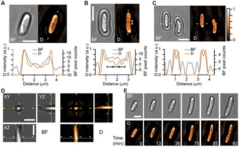 Demonstration Of Deconvolution In The BF Microscopy Images Of