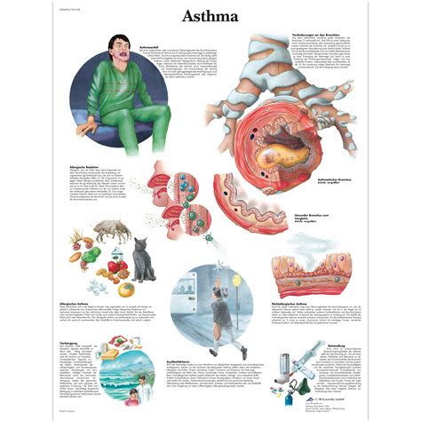 Inhalers For Asthma Chart