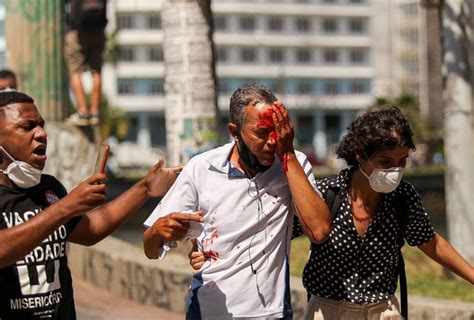 Dois Homens Atingidos Pela PM Durante Protesto No Recife Perdem Parte