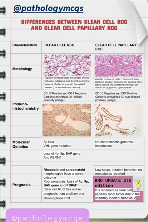 Differences Between Clear Cell Renal Carcinoma And Clear Cell Papillary