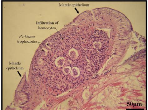 Histological Observation Of Granuloma Structure In The Connective