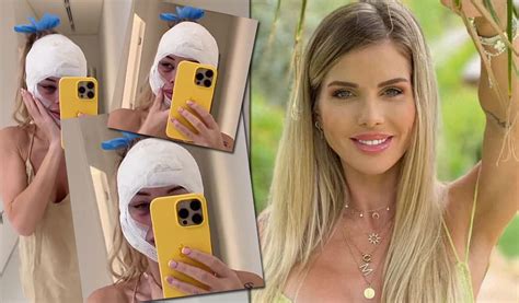 Jessica Thivenin Tout Sur Sa Derni Re Chirurgie Esth Tique Du Visage