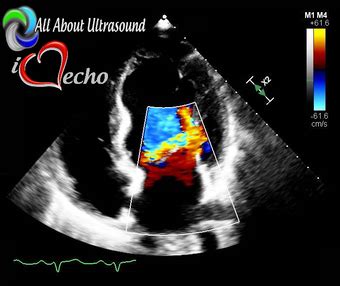 Advanced Cardiac Sonographer Registry Review