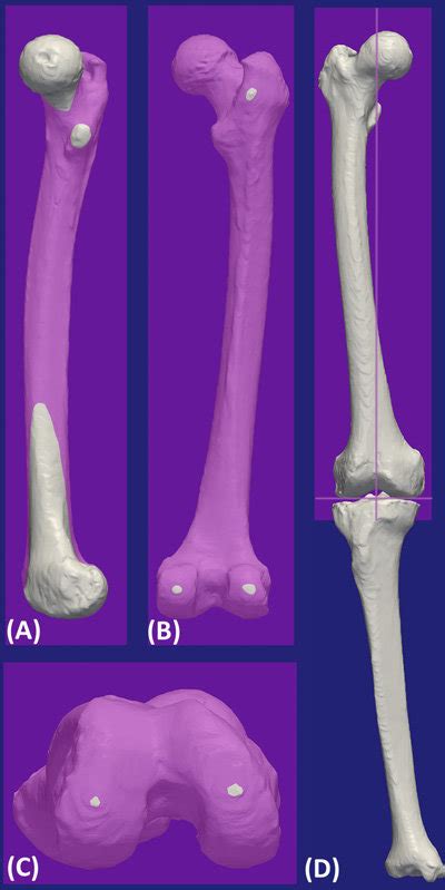 A Through 2 D Illustrations Of The Distal Aspect Of A Right Femur Download Scientific Diagram