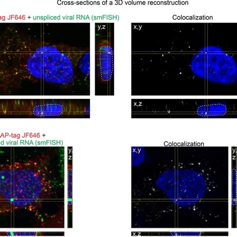 Subcellular Localization Of Wild Type Gag Cfp And Unspliced Vrna In Qt