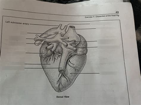 fetal pig heart dorsal view Diagram | Quizlet