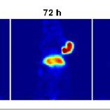 Ca Targeted Pet Imaging With Zr Dfo Mab B Serial Pet Images