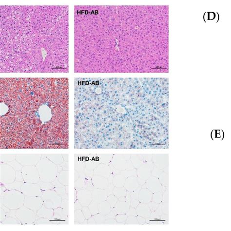 Effects Of Adzuki Bean Supplementation On A H E Staining Of Liver