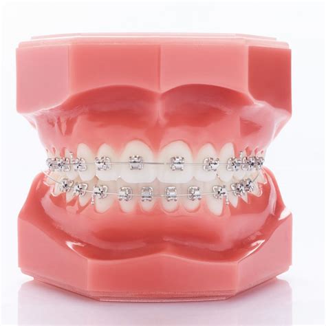 Experience Rhodium Roth Maxillary Gc Orthodontics Inc