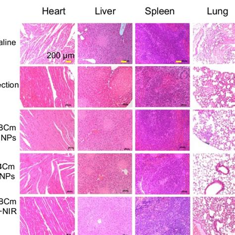 Micrographs Of Hematoxylin And Eosin Stained Pathological Sections