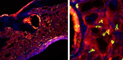 Image of the Day: Tuft Cells | The Scientist Magazine®