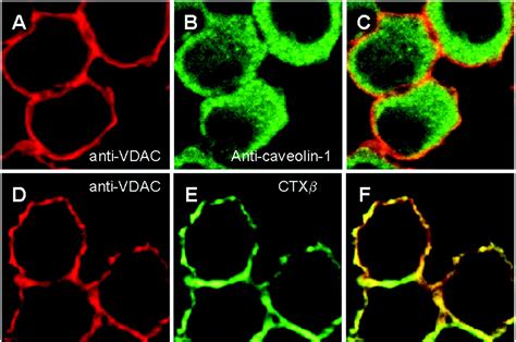 Plasma Membrane Voltage Dependent Anion Channel Mediates Antiestrogen