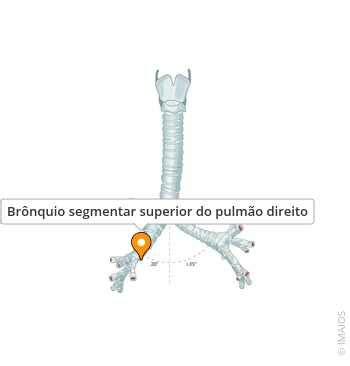 Bronquio Principal Direito - Brônquio segmentar superior do pulmão direito - e-Anatomy - IMAIOS