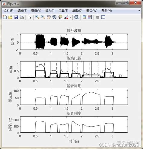 Matlab语音信号分析与合成（第二版）》：第10章 语音信号的合成算法 知乎