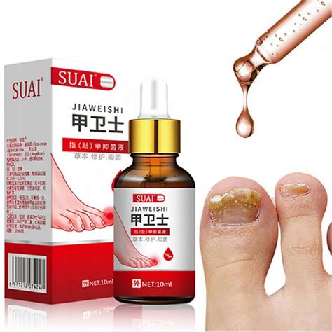 Leczenie Grzybicze Paznokci Serum Onychomycosis Allegro Pl