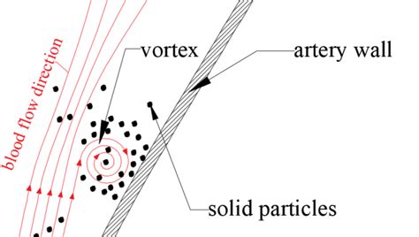 Deposition Of Solid Particles Following The Vortex Formation