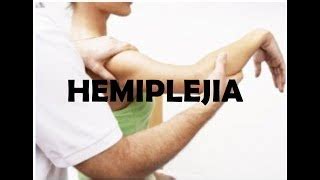 QUÉ ES LA HEMIPLEJIA Doovi