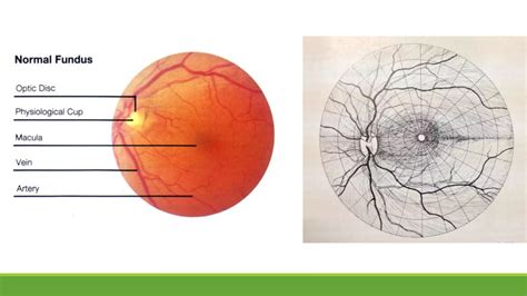 Fundus examination | PPT