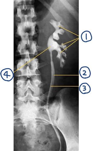 Anatomy - (X-ray) Ascending pyelography (retrograde urography) Flashcards | Quizlet