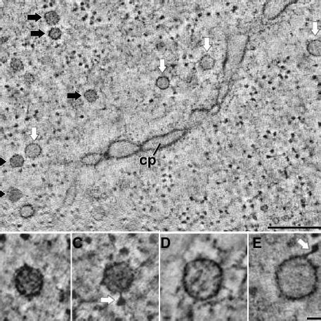 Two Different Types of Vesicles in the Vicinity of the Cell Plate ...