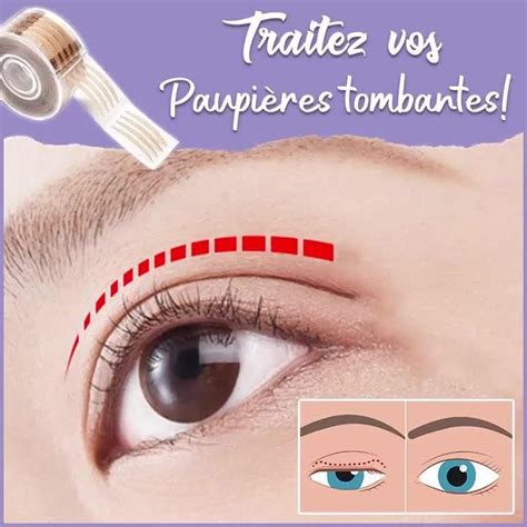 Eyelift Patches Pour Paupi Res Tombantes Nat Rliche Sch Nheit