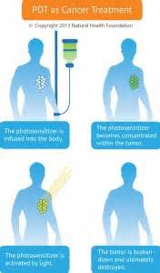 Photodynamic Therapy