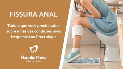 Fissura anal o que é quais os sintomas e as opções de tratamento