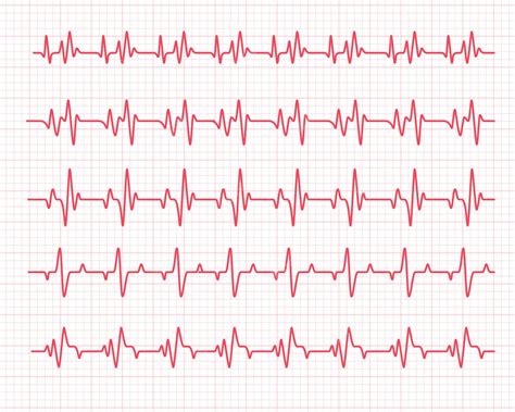 Gráfico De Ritmo Cardíaco Comprobación De Los Latidos Del Corazón Para El Diagnóstico Vector