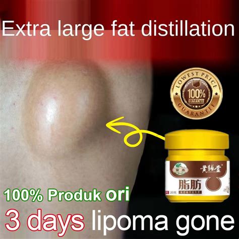 Lipoma Cream Ointment Fat Granule Care External Swelling Cellulite