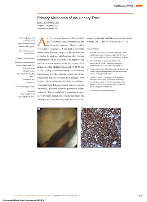 Pdf Primary Melanoma Of The Urinary Tract