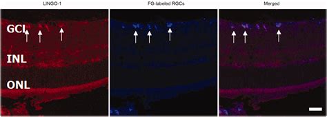 Blocking LINGO 1 In Vivo Reduces Degeneration And Enhances Regeneration